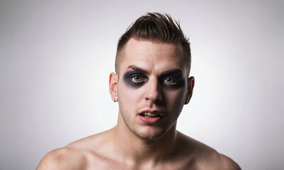 A man with a black eye looks directly at the camera