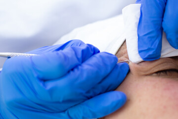 Manos de dermatóloga en el rostro de un paciente
Dermatologist’s hands on patient’s face