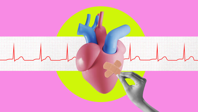 Poster. Contemporary art collage. Stylized heart with heartbeat graph in background, hand placing bandage on it. Concept of human healthcare, cardiovascular, emergency, medicine. Ad - Powered by Adobe