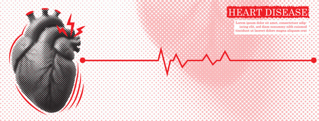 Banner related to Heart Diseases. Halftone human heart with pulse line. Vintage trendy style. Vector illustration.