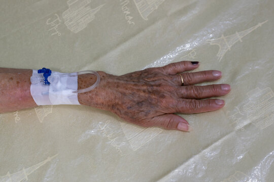 Cat&eacute;ter venoso perif&eacute;rico. Dispositivo para extraer sangre y administrar tratamientos, como l&iacute;quidos intravenosos, medicamentos o transfusiones de sangre.