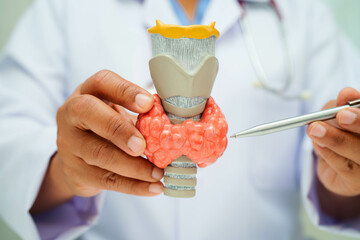 Hyperthyroidism, Overactive Thyroid, Thyroid Lymphoma, Asian doctor with thyroid gland human anatomy model in hospital.