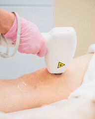 Laser hair removal procedure in the aesthetic medicine salon - smooth skin without damage to the epidermis