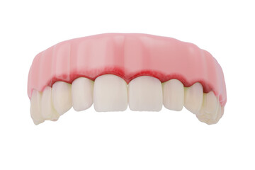 inflamed gums showing early signs of gingivitis. 3D rendering.