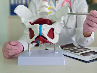 Doctor holds model of pelvic bone. Effective treatment of chronic pelvic pain concept