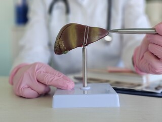 Doctor is holding mock up of human liver