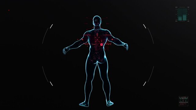Non-Hodgkin lymphoma holographic AI non Hodgkin's lymphoma treatments