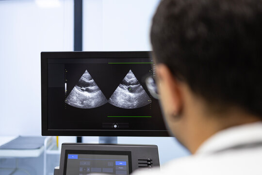 Experienced cardiologist performing ultrasound heart examination and checking heart condition on monitor.