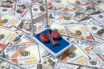 Human kidney and money. Buy and sell human organs, medical expenses concept