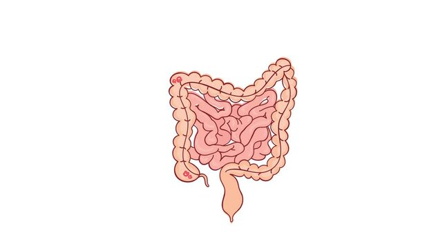 POLYPS OF THE COLON Intestines Medicine Anatomical Video Scheme Animation for Education