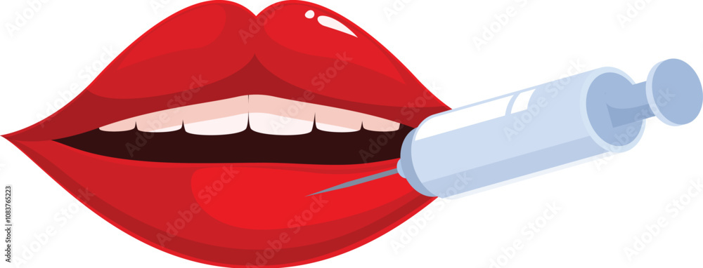 Poster procedure for lip augmentation using syringe injecting filler into red lips