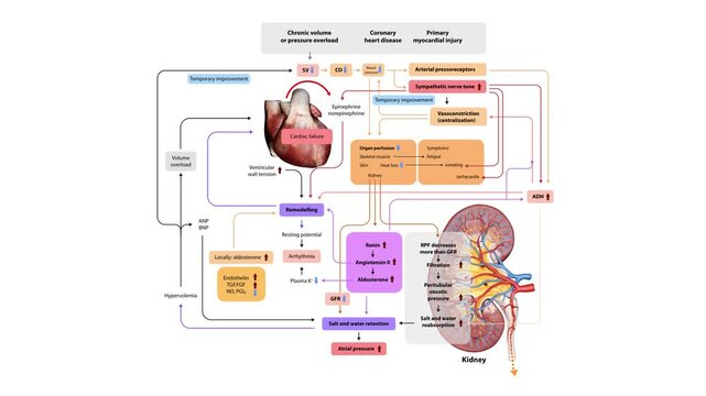 pathophysiology of heart failure, detailing mechanisms like volume overload, neurohormonal activation, remodeling, and organ perfusion changes