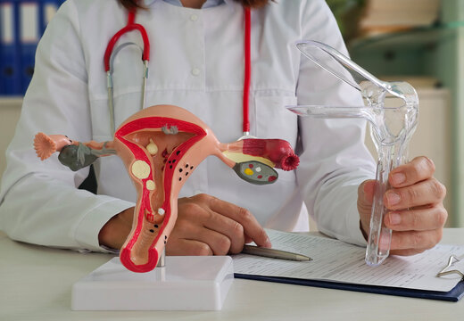 Doctor holding an anatomical model of the female reproductive system and a speculum during a patient consultation