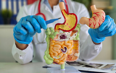 Surgeon held scalpel over an anatomical model of human stomach. Photosurgical treatment of stomach diseases and procedures concept