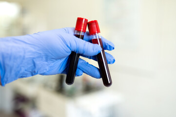 Hands of a doctor or nurse in blue medical gloves hold test tubes with blood. Blood sampling in the...