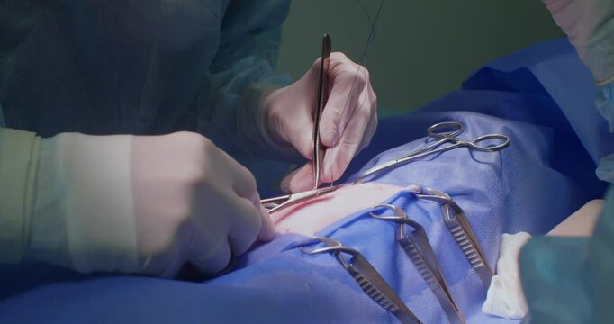 A veterinarian carefully stitches up a surgical wound on an animal. The surgeon is wearing a blue surgical gown and gloves. The veterinarian finishes the operation by applying stitches.