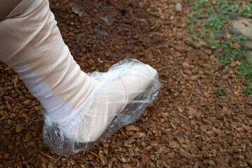 Wearing a plastic bag over the cast while walking