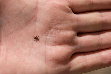 The tick Ixodes ricinus crawling on human skin. Encephalitis tick.