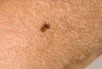 The tick Ixodes ricinus crawling on human skin. Encephalitis tick. This kind of animal is a distributor of borrelia
