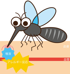 デフォルメ　蚊　吸血している　図