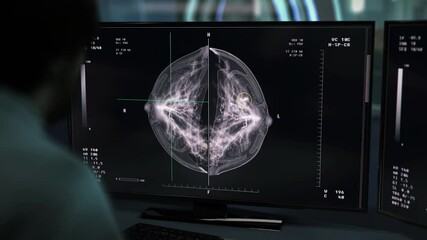 Medical imaging procedure for diagnosis of diseases. Medical imaging of the patients breast for diagnosis. Diagnosis of the dangerous breast cancer after medical mammography imaging. Healthcare.