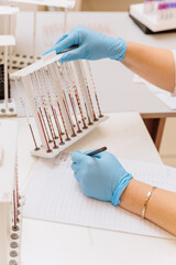 Lab technician analyzing blood samples for medical testing in a modern laboratory setting