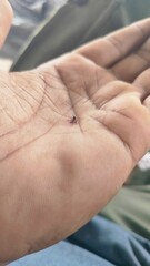 Macro photography of mosquito and its blood,Mosquito is slapped and died on the palm.