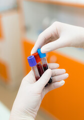 Tech managing blood samples in clinic. A laboratory technician holds two blood sample tubes while...