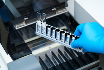 Tech loading sample tubes into equipment. A laboratory technician in blue gloves places a rack of sample tubes into specialized equipment for analysis.