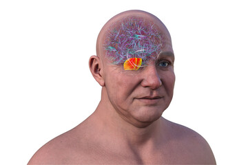 Human brain with the pons highlighted in red, 3D illustration