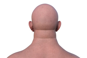 A man's hairless head from back view, 3D illustration