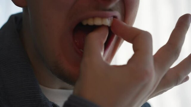 Close-up of a man's hands, a loose tooth in his mouth.
A man touches his teeth with his hands,
A man with an open mouth loosens a tooth.
Teeth, loose, treatment, caries, hand, paradantos