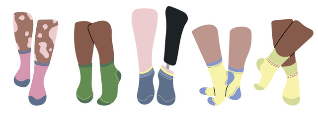 Five pairs of socks design on legs. Concept diversity white, black color skin, vitiligo, inclusive person with prosthetic leg. Blue, pink, green, yellow socks. Low cut, ankle, knee high, over the calf