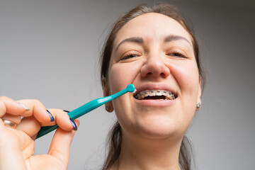 Young cheerful woman does hygiene for braces