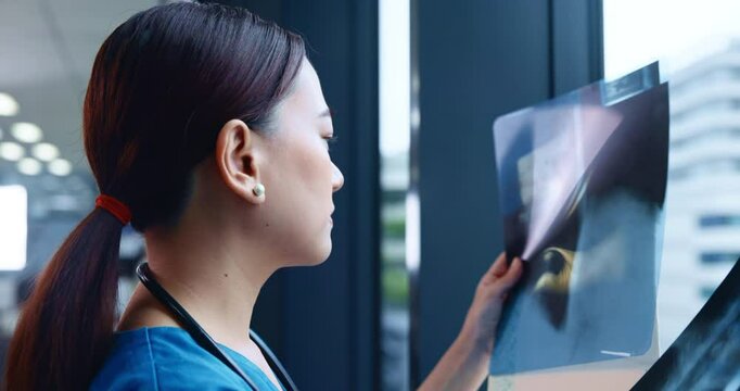 Woman, doctor and xray on window for healthcare, patient results and study in Japanese hospital. Radiologist, expert and radiograph in clinic for spinal care, osteoporosis diagnosis and arthritis