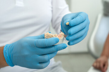 dentist holds an implant and consults an elderly woman with the installation of a tooth crown, dental clinic