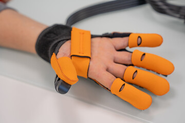 Glove rehabilitation with motor. Physiotherapy exercise for the human hand
