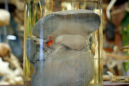 Human liver in glass flask. Major metabolic organ