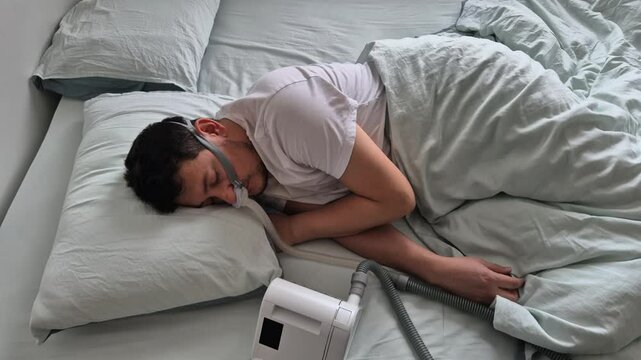A man in his mid-thirties with sleep apnea disorder, sleeps using a nasal mask and CPAP device in a bed.