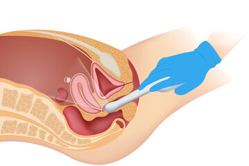 Transvaginal ultrasound scanner of the internal pelvic organs. The concept of women's health