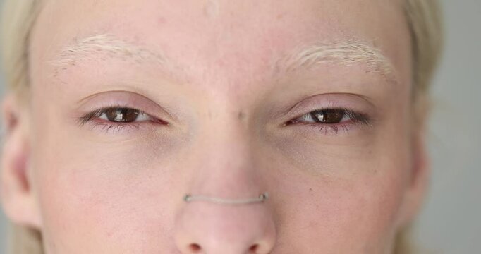 Closeup of eyes and nose of woman with blond hair, brown eyes and pering