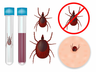 Ixodida or ticks. Tick-borne encephalitis  and Lyme borreliosis vaccination.