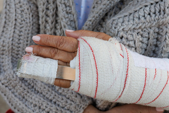 Vendaje con f&eacute;rula para inmovilizar rotura o lesi&oacute;n en el dedo anular