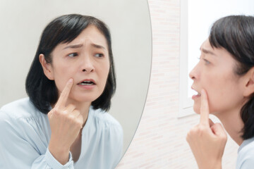 ほうれい線に悩むミドル女性（美容）..