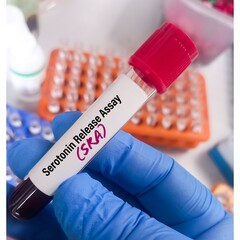 Blood sample for Heparin Induced Thrombocytopenia (HIT) PF4 Antibody, IgG with Reflex to Serotonin...