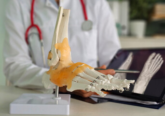 Foot pain, top, inflammatory, arthritis, fracture, nerve compression, tarsal tunnel syndrome