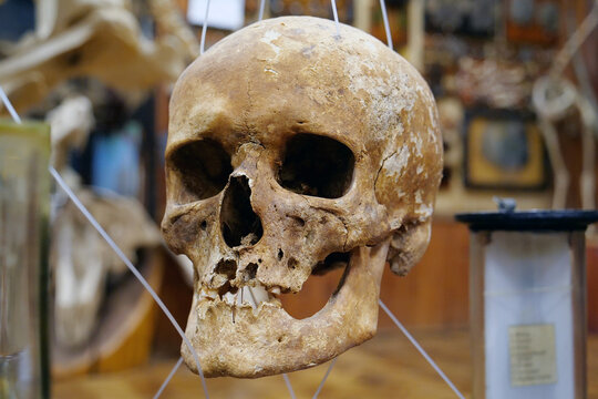 Bones of human skull for studying. Human skull
