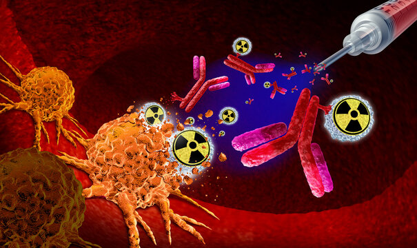 Targeted Alpha Therapy as a cancer treatment in clinical trials as a oncology therapies targeting malignant tumors with radioactive particles destroying cells