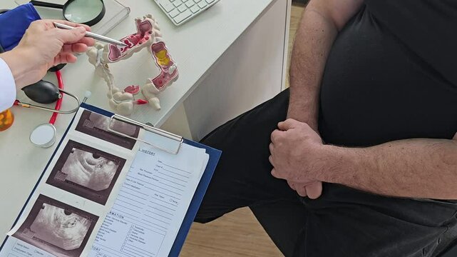 Treatment cancer colon. Doctor pointing pen tumor intestines using an anatomical model