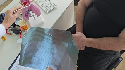 Doctor checks x-ray of lungs, consults patient with positive result for coronavirus. Man listens to diagnosis of pneumonia concept 